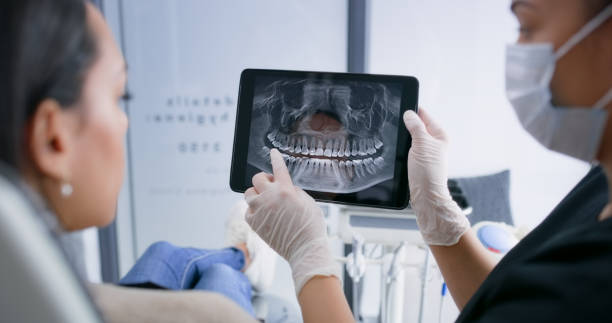 Licensed Wisdom Tooth Removal service in McQueeney, TX - Dentist Open Now